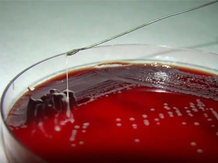 How To String Test A Horse? • Support Wild